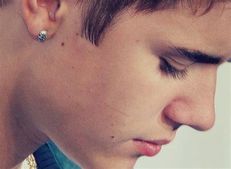 justin bieber circumcision scar.